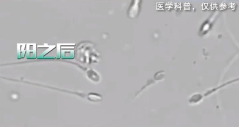 阳康后,多久能过正常性生活