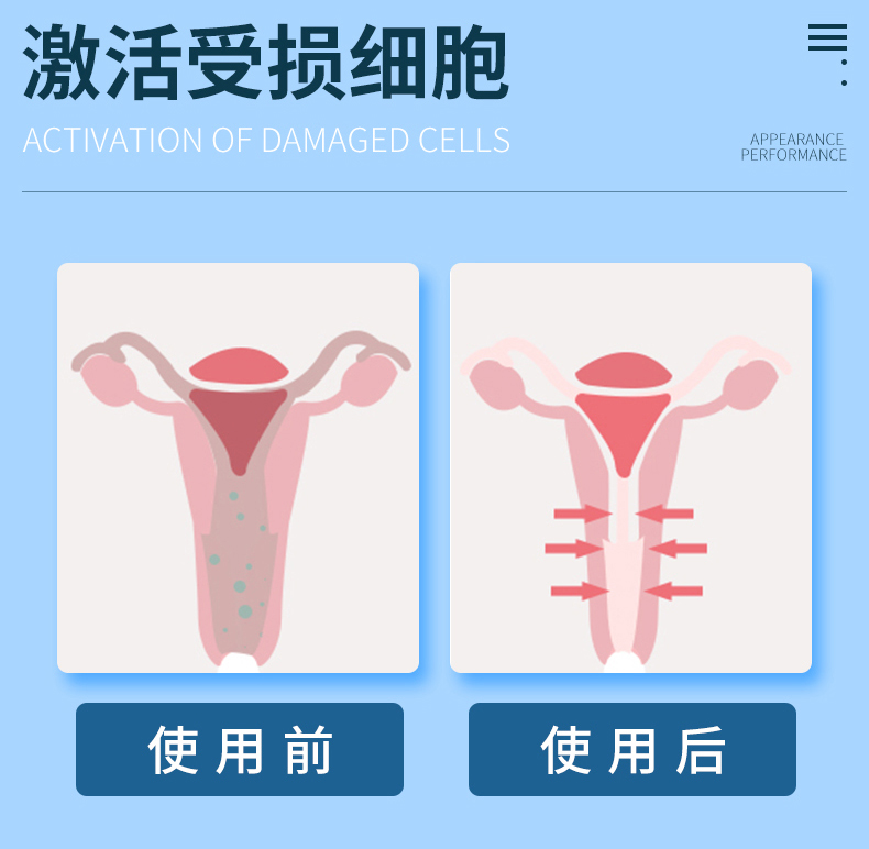 趣爱阁-成年用品批批发缩阴丰胸：斯汉德SHD-S011樱桃缩阴哑铃缩阴丰胸